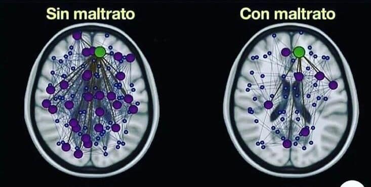 secuelas del matrato psicologico